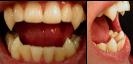 Graphic courtesy of teethbydnash.com
